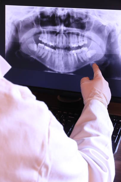 Best Emergency Root Canal Therapy in Riddle, OR